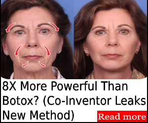 Applying Synevra UltraLift Snake Venom Serum to fine lines